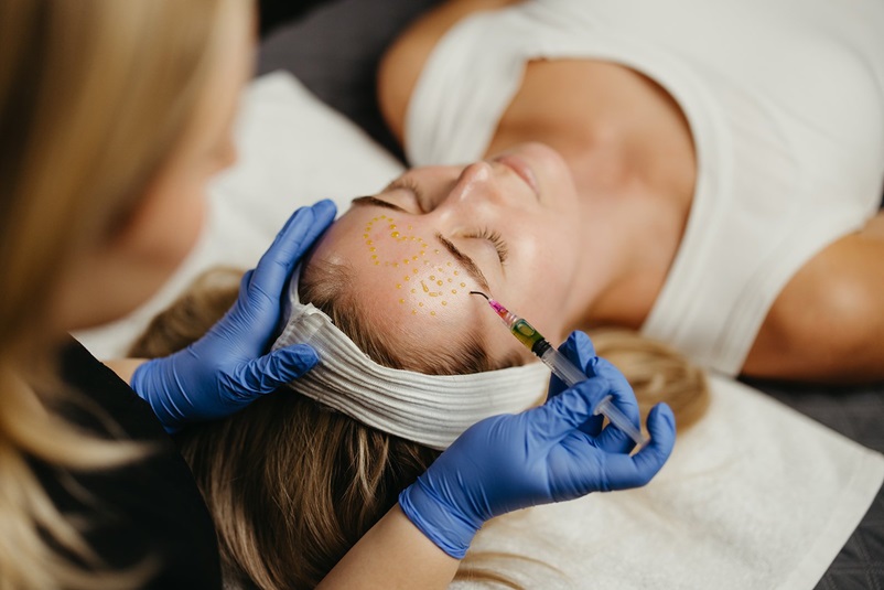 Laser hair removal in progress