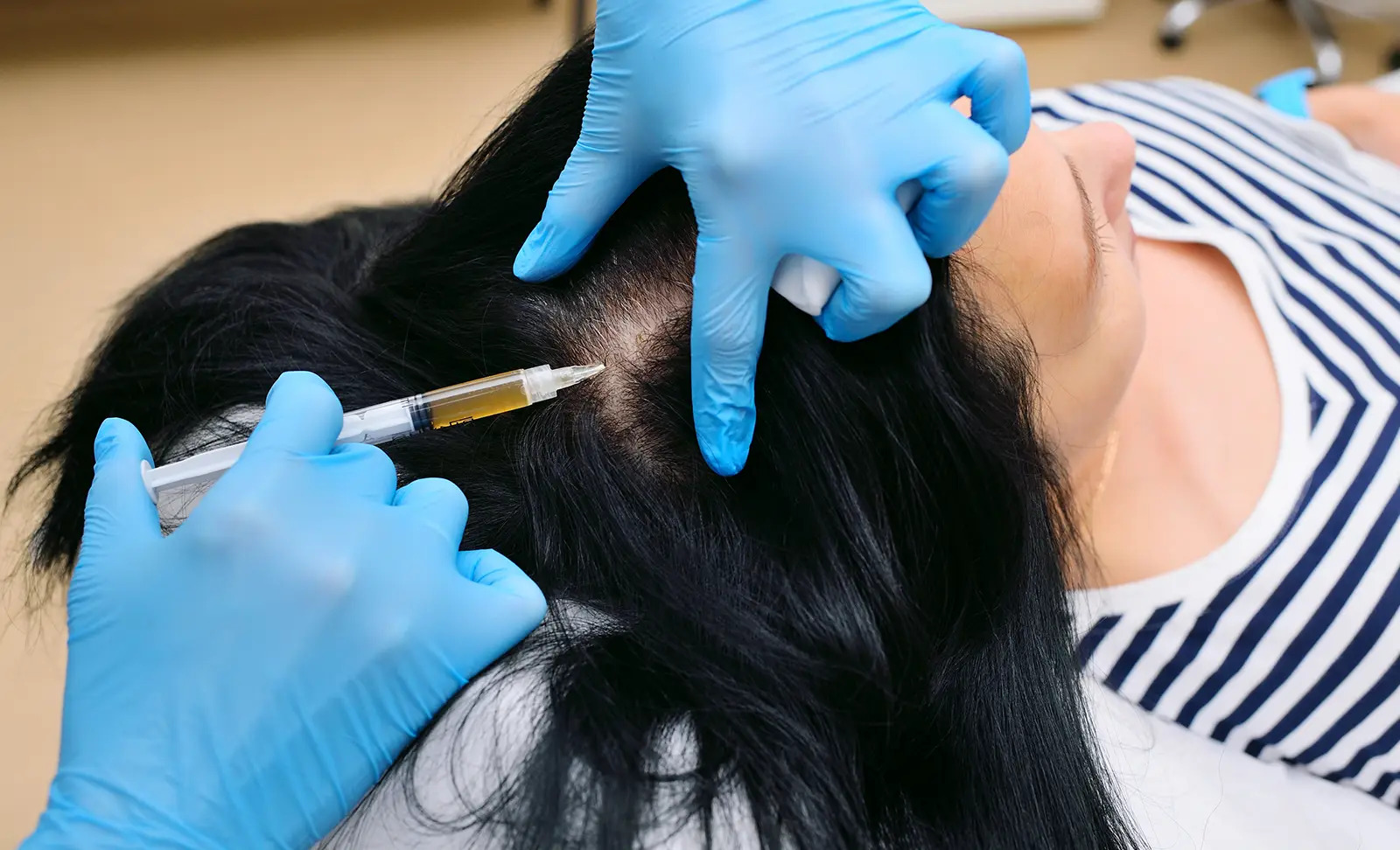 Laser Hair Removal Treatment at Aesthetics By Irum