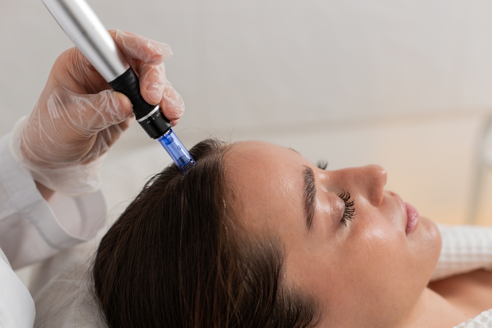 After laser hair removal results