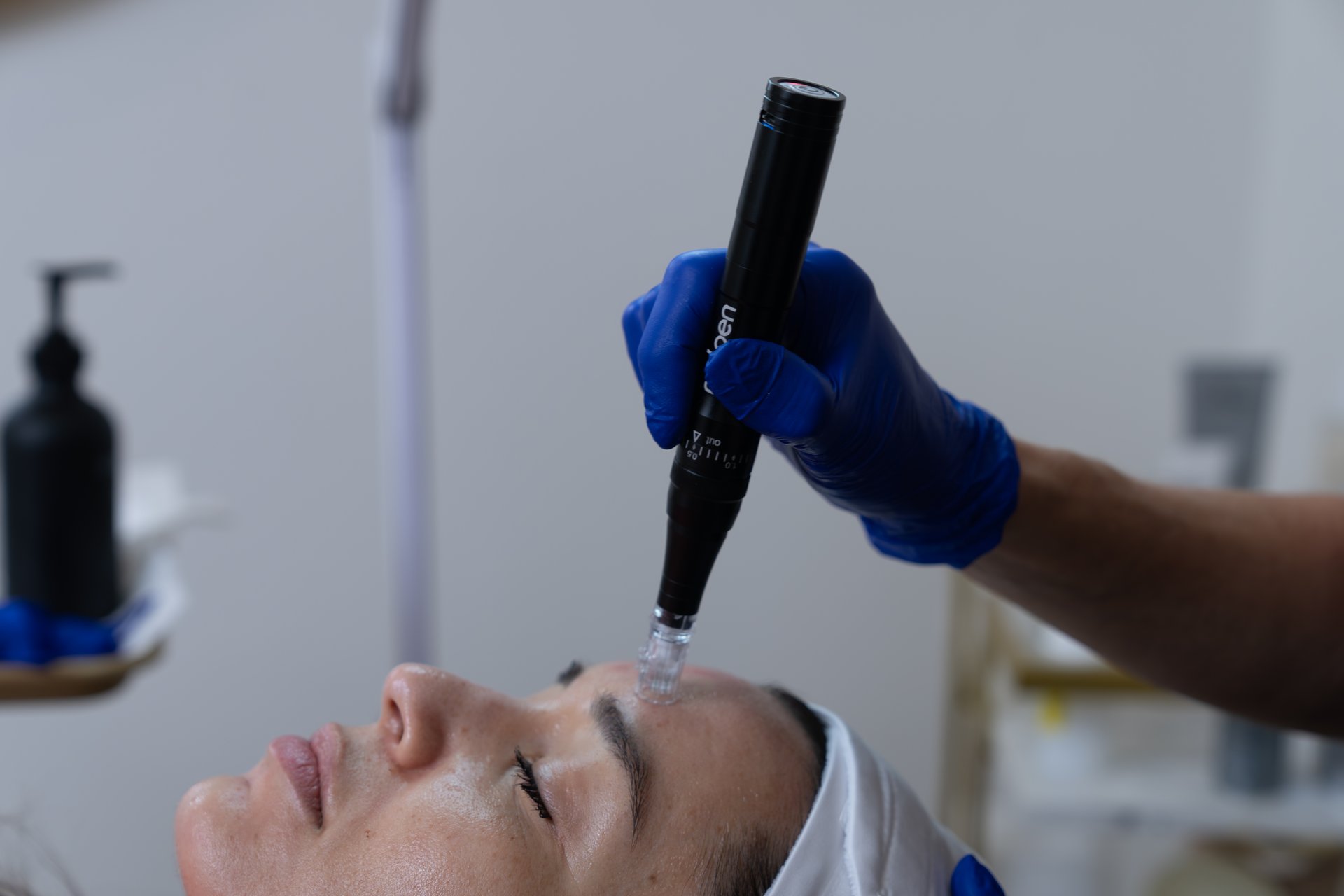 Before laser hair removal treatment